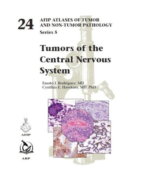 Tumors of the Central Nervous System