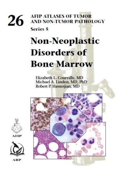 Non-Neoplastic Disorders of Bone Marrow