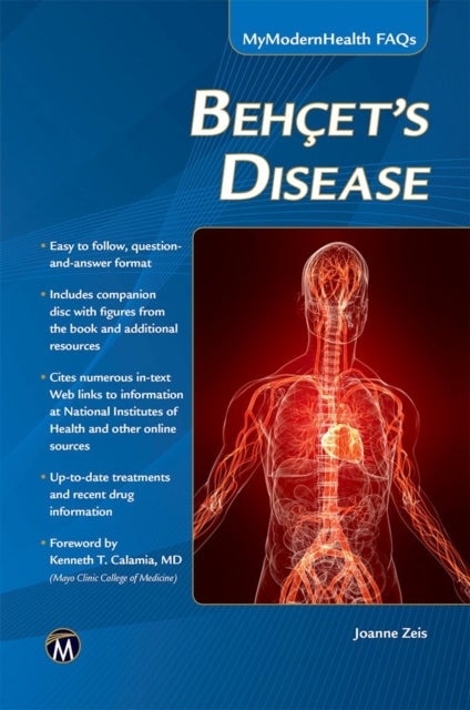 Behcet’s Disease