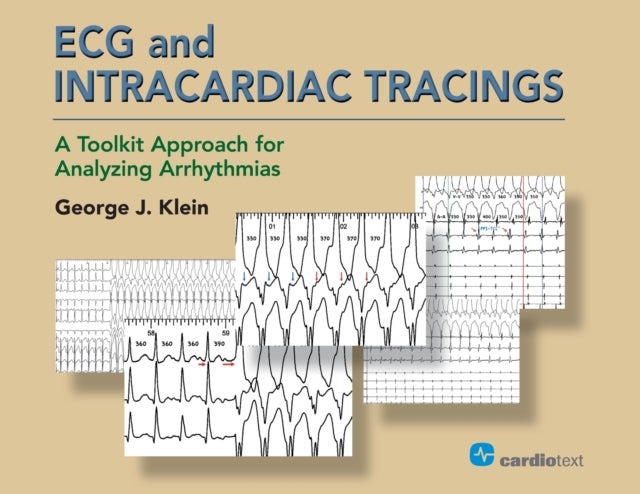 ECG and Intracardiac Tracings - A Toolkit Approach for Analyzing Arrhythmias