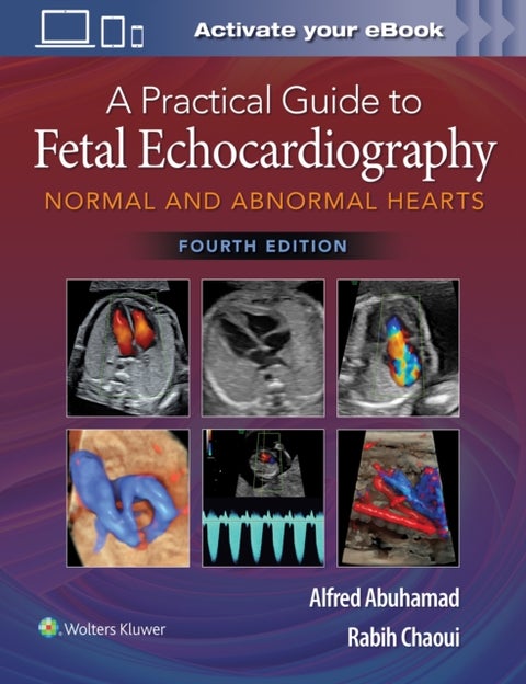 A Practical Guide to Fetal Echocardiography - Normal and Abnormal Hearts