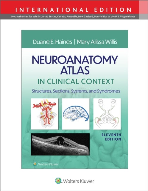 Neuroanatomy Atlas in Clinical Context - Structures, Sections, Systems, and Syndromes