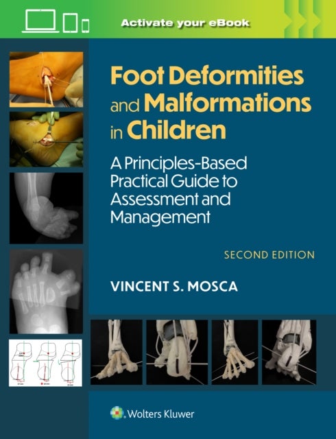 Foot Deformities and Malformations in Children - A Principles-Based, Practical Guide to Assessment and Management: Print + eBook with Multimedia