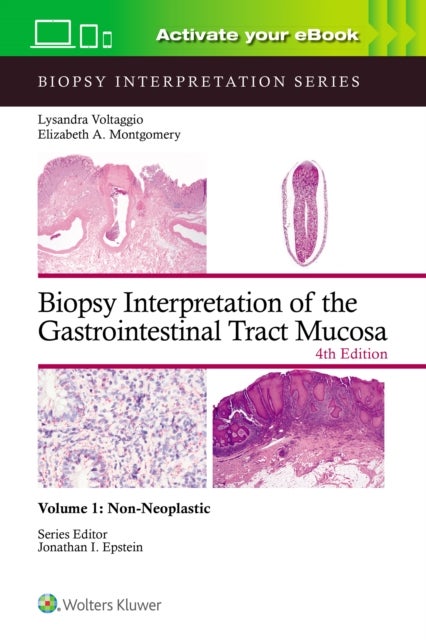 Biopsy Interpretation of the Gastrointestinal Tract Mucosa Volume 1 - Non-Neoplastic: Print + eBook with Multimedia