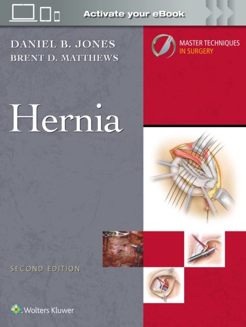Master Techniques in Surgery: Hernia: Print + eBook with Multimedia