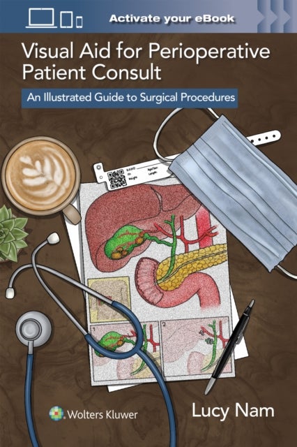 Visual Aid for Perioperative Patient Consult - An Illustrated Guide to Surgical Procedures