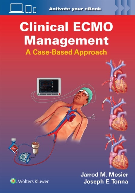 Clinical ECMO Management - A Case-Based Approach