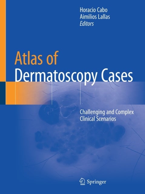 Atlas of Dermatoscopy Cases - Challenging and Complex Clinical Scenarios