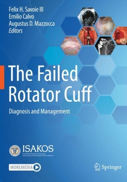 The Failed Rotator Cuff - Diagnosis and Management