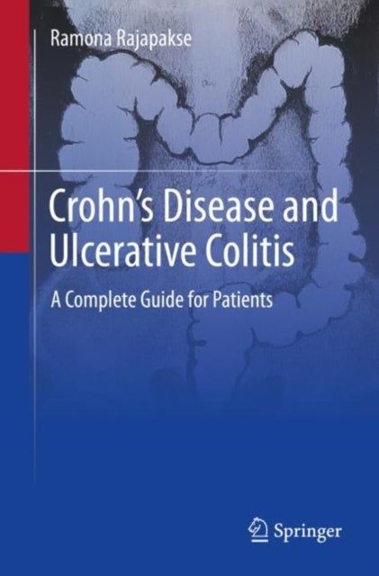 Crohn's Disease and Ulcerative Colitis - A Complete Guide for Patients