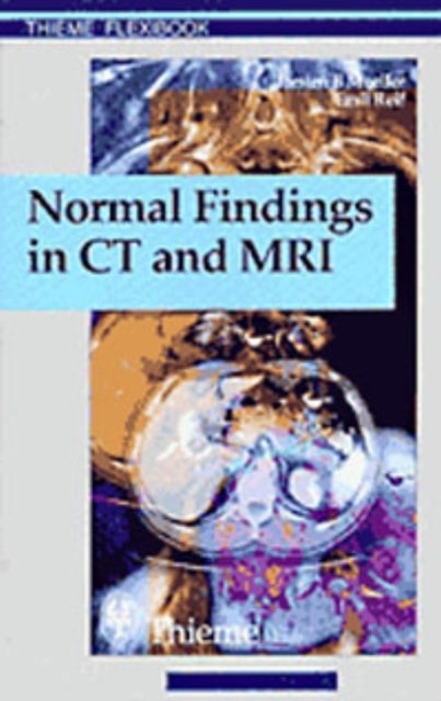 Normal Findings in CT and MRI, A1, Print
