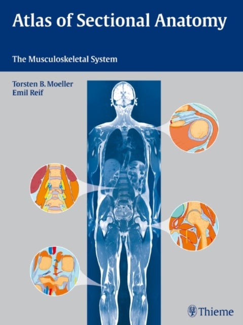 Atlas of Sectional Anatomy - The Musculoskeletal System
