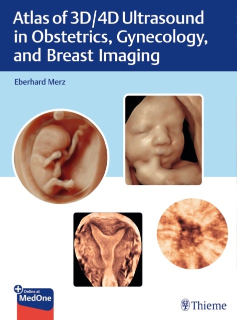 Atlas of 3D/4D Ultrasound in Obstetrics, Gynecology, and Breast Imaging - Principles and Practice