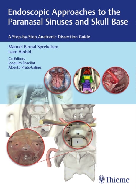 Endoscopic Approaches to the Paranasal Sinuses and Skull Base - A Step-by-Step Anatomic Dissection Guide
