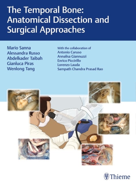 The Temporal Bone - Anatomical Dissection and Surgical Approaches
