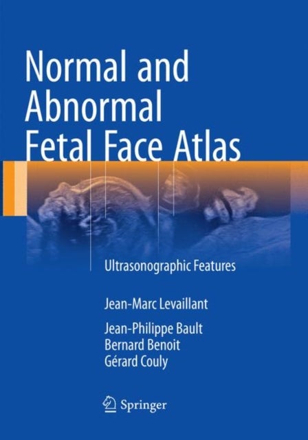 Normal and Abnormal Fetal Face Atlas - Ultrasonographic Features