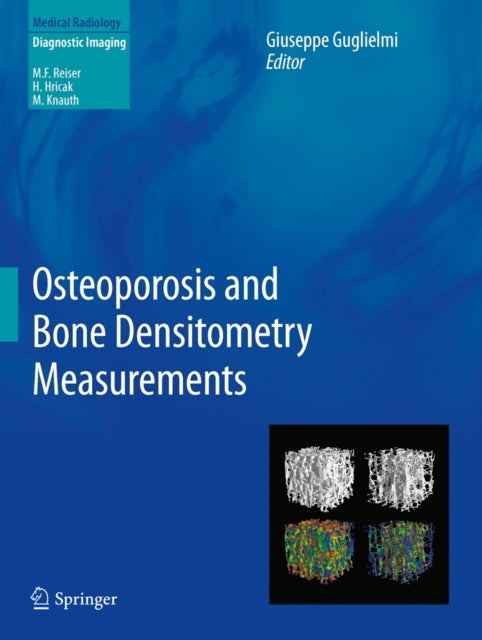 Osteoporosis and Bone Densitometry Measurements
