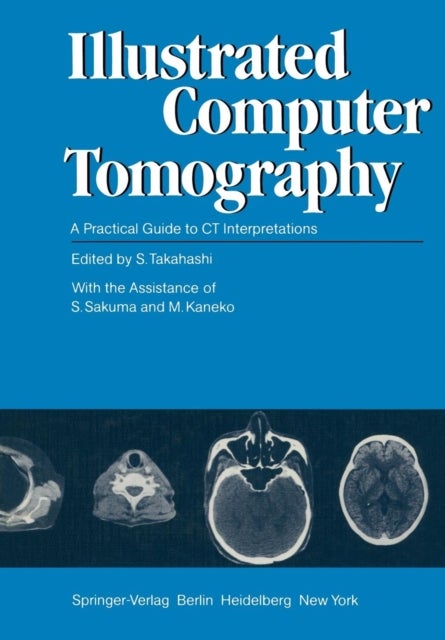 Illustrated Computer Tomography - A Practical Guide to CT Interpretations