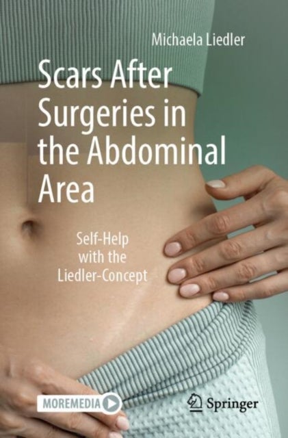 Scars After Surgeries in the Abdominal Area - Self-Help with the Liedler-Concept