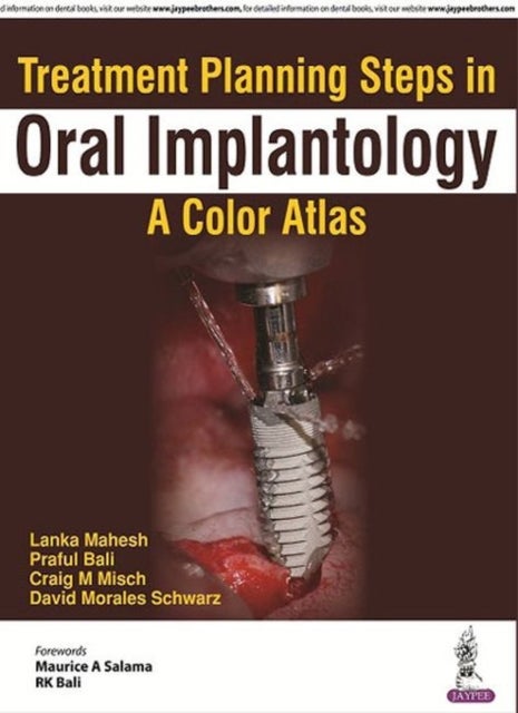 Treatment Planning Steps in Oral Implantology - A Color Atlas