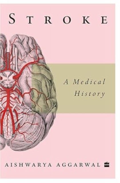 Stroke - A Medical History