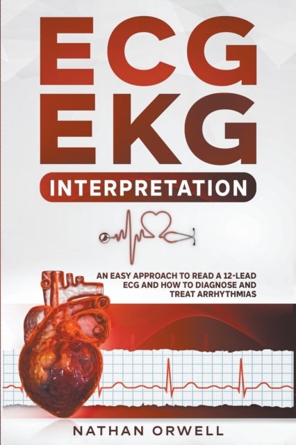 ECG/EKG Interpretation - An Easy Approach to Read a 12-Lead ECG and How to Diagnose and Treat Arrhythmias