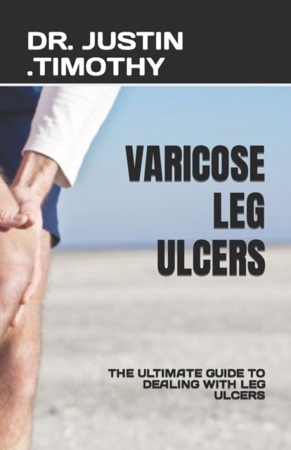 Varicose Leg Ulcers - The Ultimate Guide to Dealing with Leg Ulcers