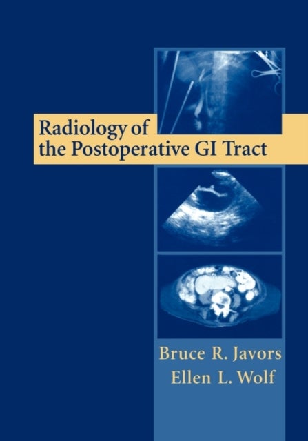 Radiology of the Postoperative GI Tract