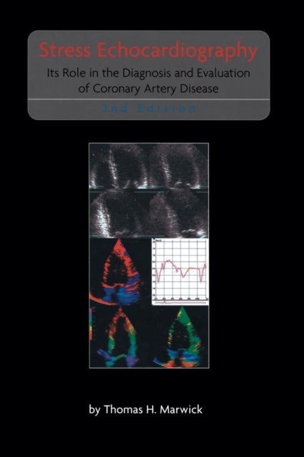 Stress Echocardiography - Its Role in the Diagnosis and Evaluation of Coronary Artery Disease