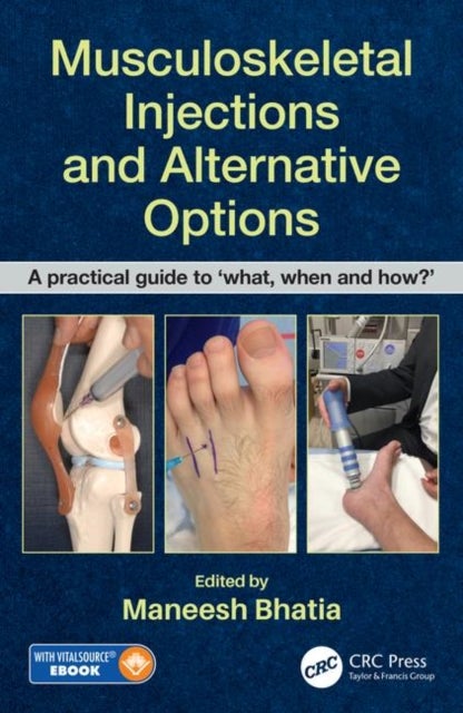 Musculoskeletal Injections and Alternative Options - A practical guide to 'what, when and how?'
