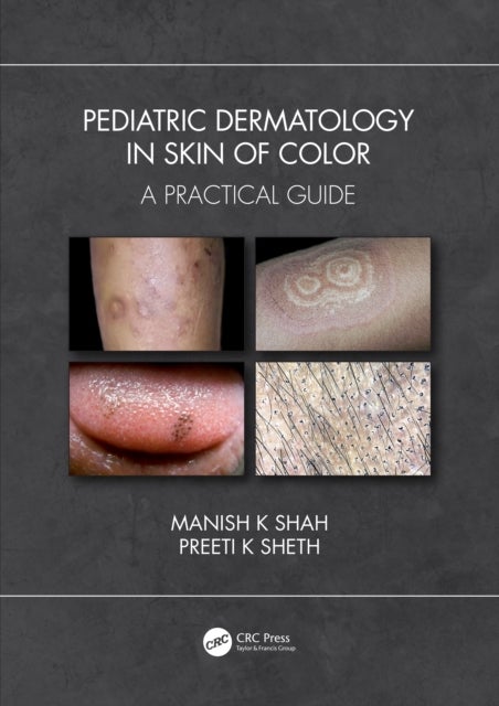 Pediatric Dermatology in Skin of Color - A Practical Guide