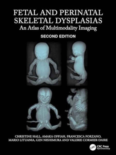 Fetal and Perinatal Skeletal Dysplasias - An Atlas of Multimodality Imaging