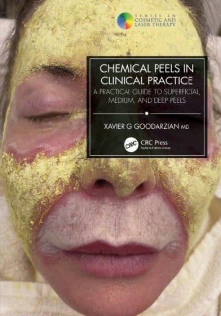 Chemical Peels in Clinical Practice - A Practical Guide to Superficial, Medium, and Deep Peels