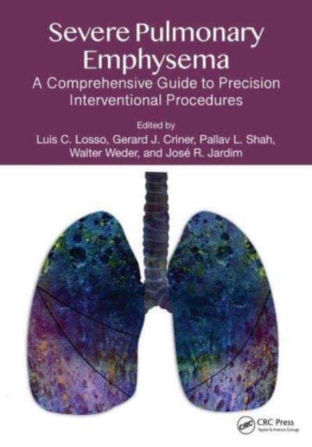 Severe Pulmonary Emphysema: - A Comprehensive Guide to Precision Interventional Procedures
