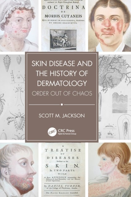 Skin Disease and the History of Dermatology - Order out of Chaos