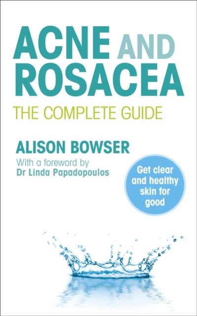 Acne and Rosacea - The Complete Guide