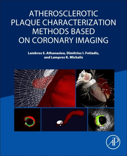 Bilde av Atherosclerotic Plaque Characterization Methods Based On Coronary Imaging Av Lambros S (information And Communication Systems Engineer Institute For M