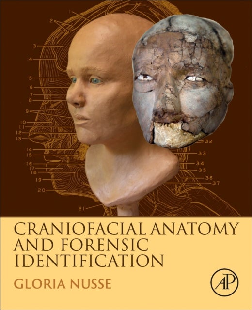 Bilde av Craniofacial Anatomy And Forensic Identification Av Gloria (forensic Artist And Professor San Francisco State University San Francisco Ca Usa) Nusse