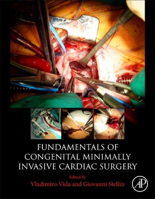 Bilde av Fundamentals Of Congenital Minimally Invasive Cardiac Surgery Av Vladimiro (pediatric Cardiac Surgery Unit University Of Padua Medical School Italy) V