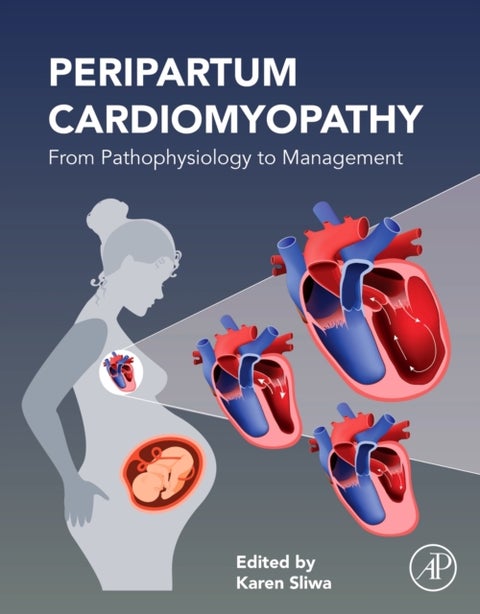 Peripartum Cardiomyopathy - From Pathophysiology to Management