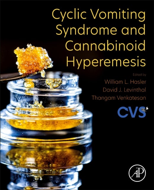 Bilde av Cyclic Vomiting Syndrome And Cannabinoid Hyperemesis