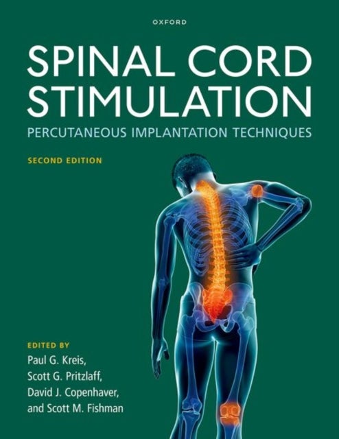 Bilde av Spinal Cord Stimulation