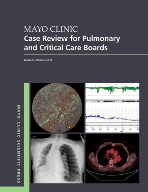 Bilde av Mayo Clinic Case Review For Pulmonary And Critical Care Boards Av Mayo Clinic Scientific Press Series