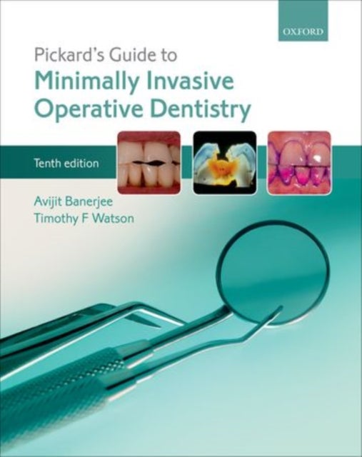 Bilde av Pickard&#039;s Guide To Minimally Invasive Operative Dentistry Av Avijit (professor Of Cariology &amp; Operative Dentistry Professor Of Cariology &amp