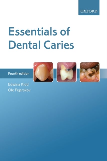 Bilde av Essentials Of Dental Caries Av Edwina (emerita Professor Of Cariology Emerita Professor Of Cariology King&#039;s College London London Uk) Kidd, Ole (