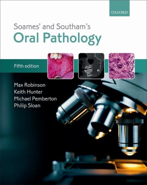 Bilde av Soames&#039; &amp; Southam&#039;s Oral Pathology Av Max (senior Lecturer In Oral Pathology Senior Lecturer In Oral Pathology School Of Dental Science