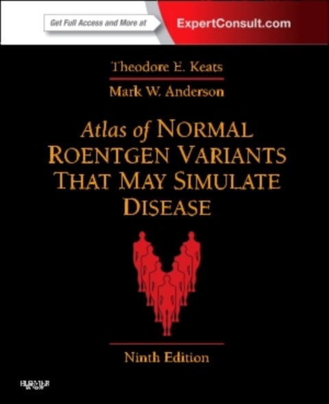 Atlas of Normal Roentgen Variants That May Simulate Disease - Expert Consult - Enhanced Online Features and Print