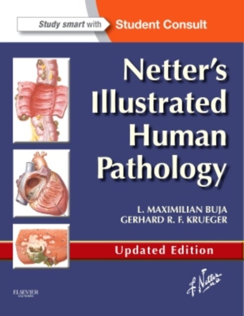 Bilde av Netter&#039;s Illustrated Human Pathology Updated Edition Av L. Maximilian M.d. (professor Of Pathology And Laboratory Medicine At The University Of T