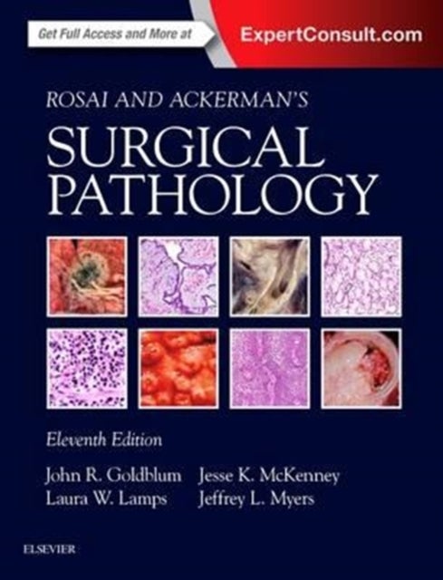 Bilde av Rosai And Ackerman&#039;s Surgical Pathology - 2 Volume Set Av John R. Md Fcap Fascp Facg (chairman Of Pathology Cleveland Clinic Goldblum, Cleveland