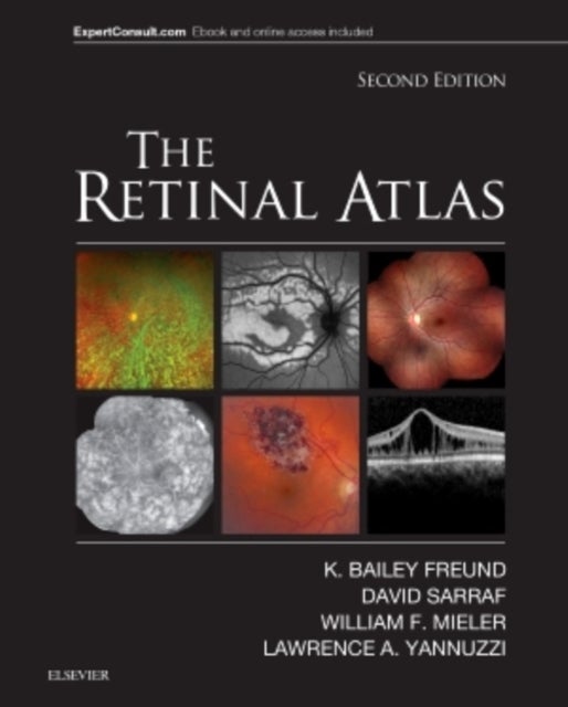 Bilde av The Retinal Atlas Av K. Bailey (clinical Professor Of Ophthalmology New York University School Of Medicine Freund, New York City Ny) Vitreous Retina M